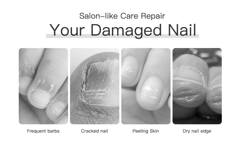 ✨✨Vaxflite™ Nail repair solution-Say Goodbye to Hangnails, Dry Cuticles & Cracked Skin – Instantly.