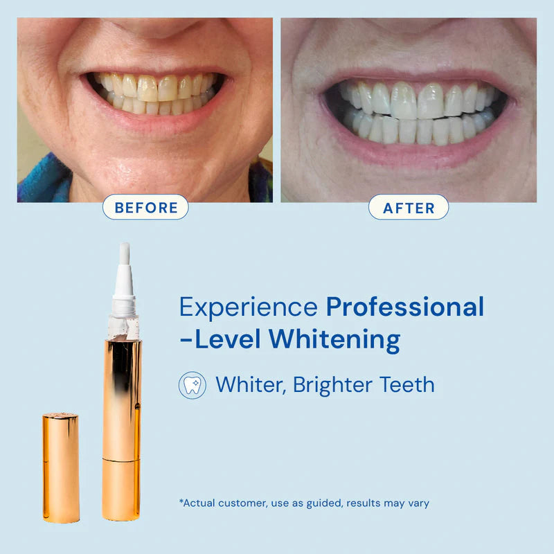 Blizkox™ Whitening Pen