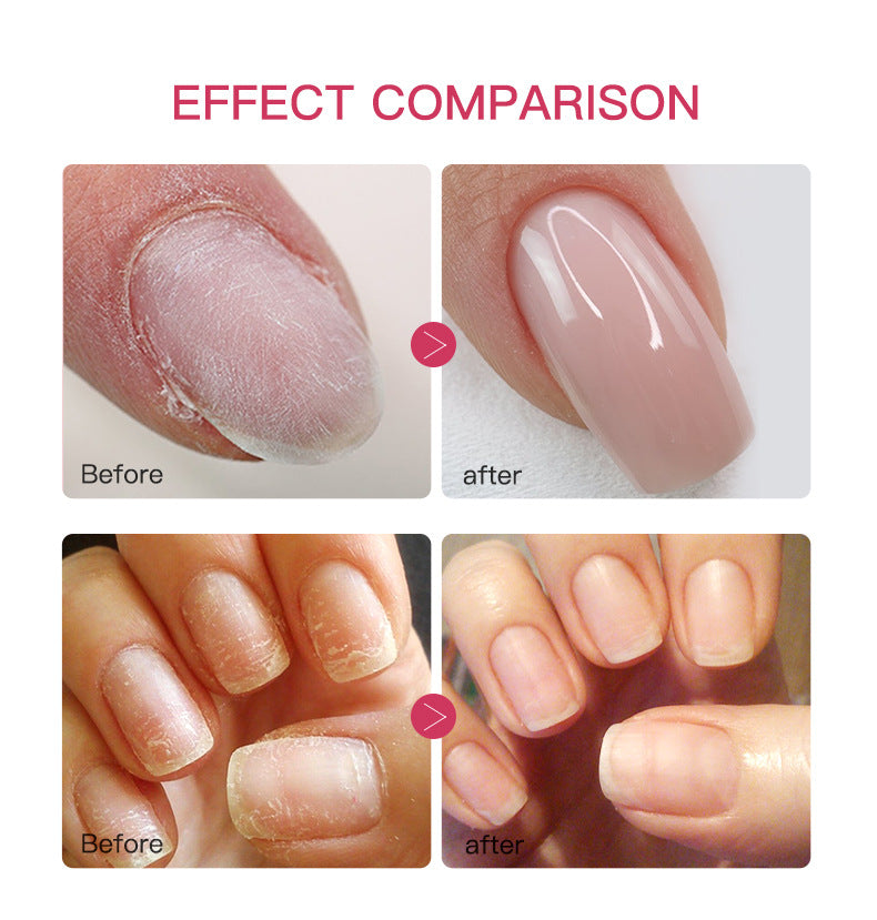 ✨✨Vaxflite™ Nail repair solution-Say Goodbye to Hangnails, Dry Cuticles & Cracked Skin – Instantly.