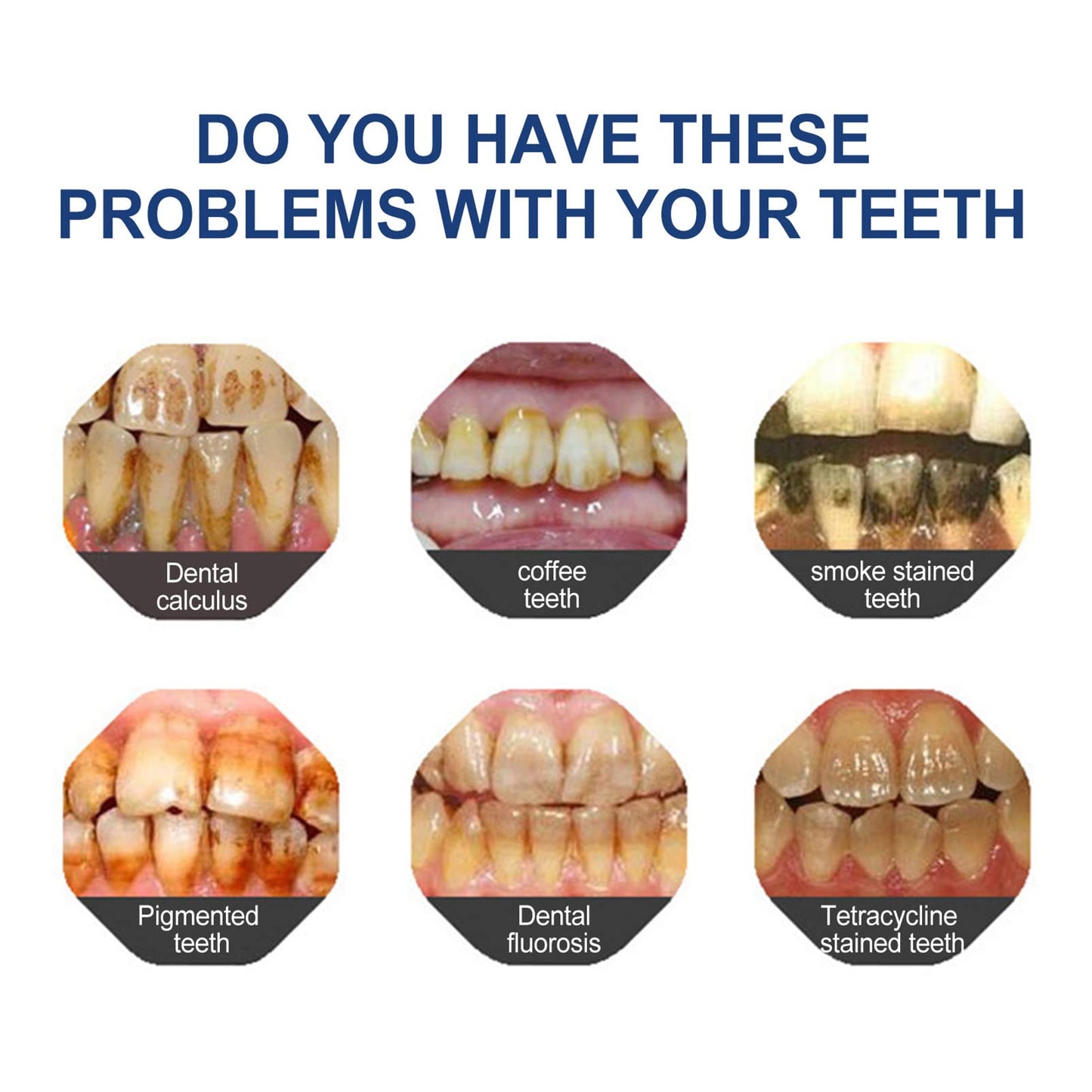 🦷🔥Final 12 Hours: 60%OFF🎁 BBOJI™ Fluoride-Free Hydroxyapatite Toothpaste 💎 Your Smile, Naturally Brighter!