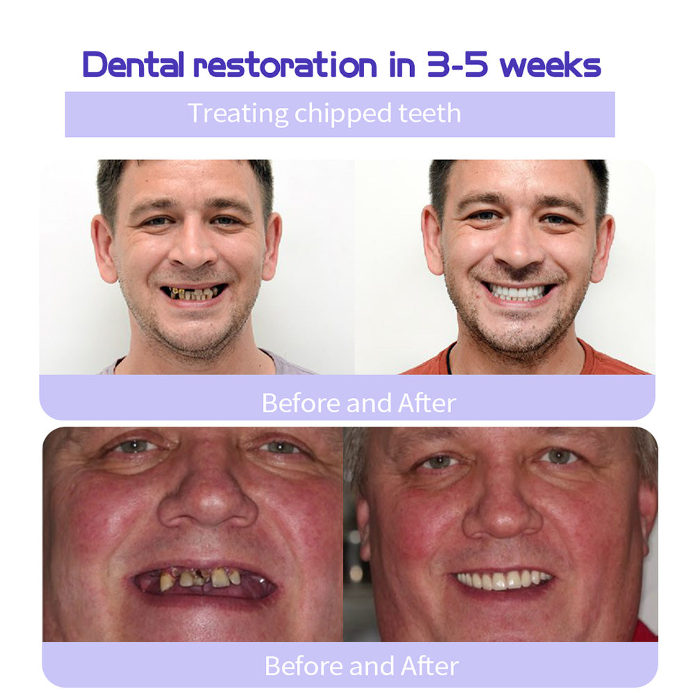 🦷🔥Final 12 Hours: 60%OFF🎁 BBOJI™ Fluoride-Free Hydroxyapatite Toothpaste 💎 Your Smile, Naturally Brighter!