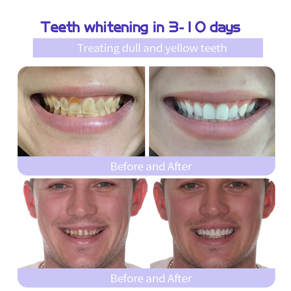 🦷🔥Final 12 Hours: 60%OFF🎁 BBOJI™ Fluoride-Free Hydroxyapatite Toothpaste 💎 Your Smile, Naturally Brighter!