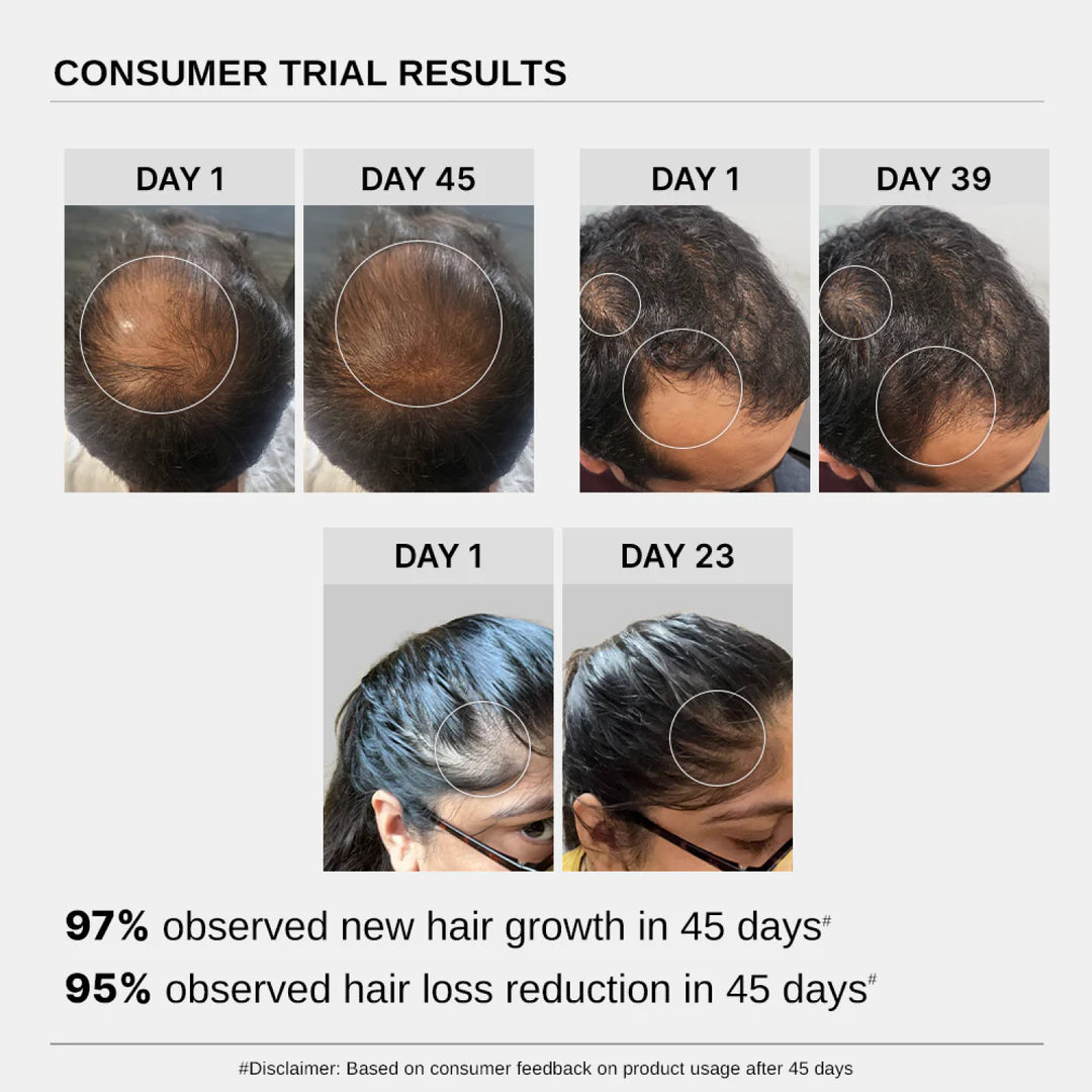 Vaxflite™ Black Sesame Serum – Regrow Your Hair, Naturally and Fast.