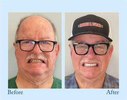 🔥Final 12 Hours: 60%OFF🎁 BBOJI™ Fluoride-Free Hydroxyapatite Toothpaste 💎 Your Smile, Naturally Brighter!
