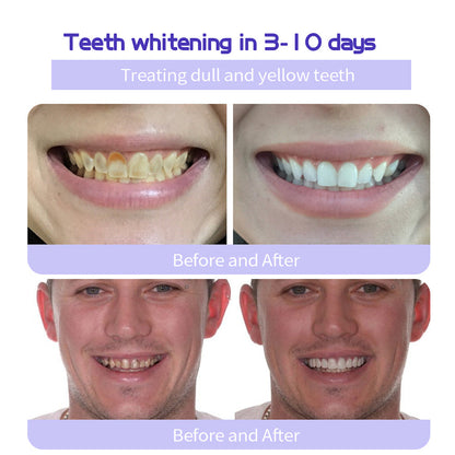 🔥Final 12 Hours: 60%OFF🎁 BBOJI™ Fluoride-Free Hydroxyapatite Toothpaste 💎 Your Smile, Naturally Brighter!